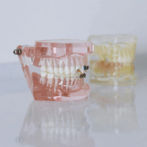 Sleep-Apnea-and-Dental-Based-Treatment-Options