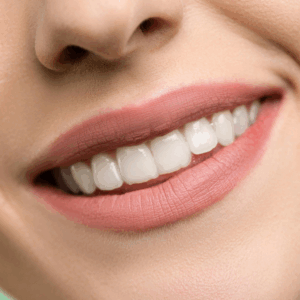 smile closeup